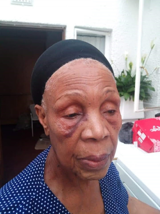 Provincial police spokesperson Brig Mathapelo Peters confirmed in a statement that Orlando police were investigating a case of common assault after the legendary musician was allegedly punched by a taxi driver.