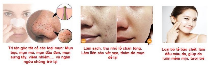 kem trị mụn ela beauty tốt nhất an toàn hiệu quả nhất hiện nay - 19