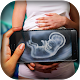 Download Xray Scanner Pregnant Prank New For PC Windows and Mac 1.0