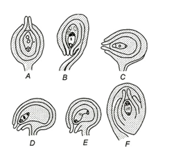 The Carpel (Megasporophyll) and the Ovule (Megasporangium)