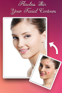 Acne Remover - Pimple Remover banner