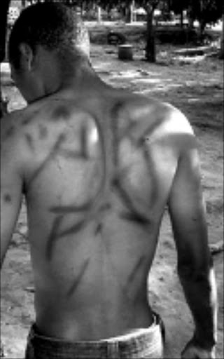 ATTACKED: Thabo Malatji showsthe marks on his back after he was allegedly assaulted at an initiation school. Pic. Michael Sakuneka. 07/2008. Sowetan.