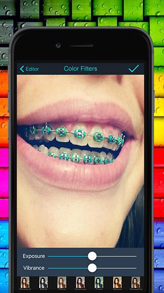 Real Braces teeth Camer Booth Screen 3
