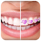 Download Braces App that look Real for Boys & Girls For PC Windows and Mac 1.0