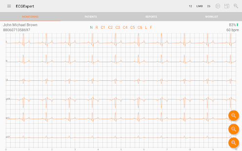 ECG Expert(圖2)-速報App