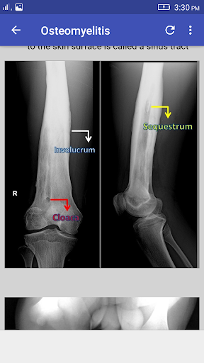 Musculoskeletal X- Rays Interpretation