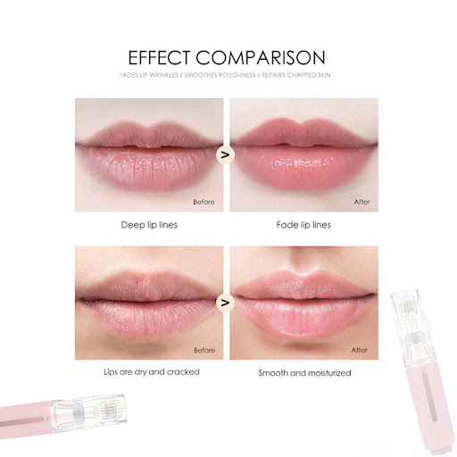 Title 1, Lip Care Roller Household Mini Introducer Set M...