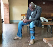 A suspected racial attack has left Silence Mabunda on crutches, five years it happened. 