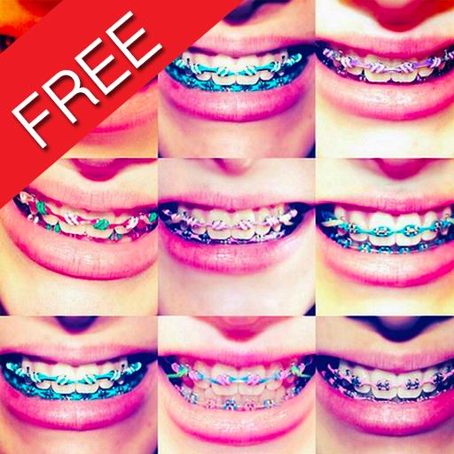 Retainer fake braces at walmart