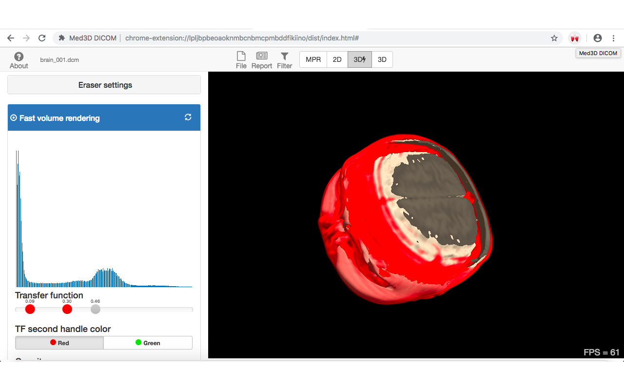 Med3D DICOM Preview image 3