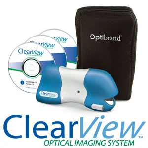 Clearview Digital Fundus Camera