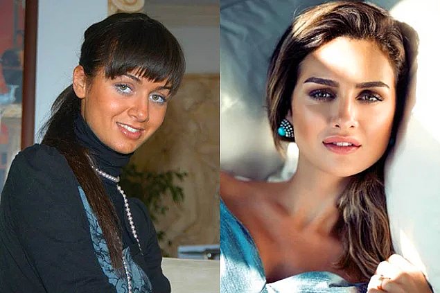 birce akalay before after