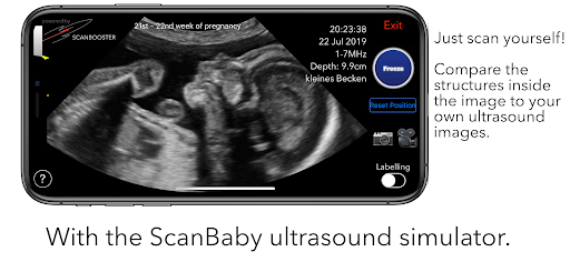 Screenshot ScanBaby learn baby ultrasound