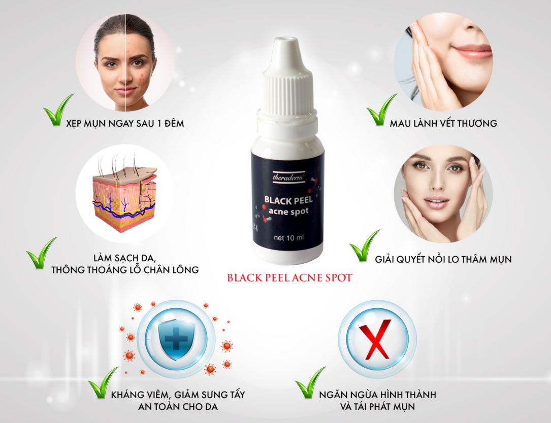  serum trị mụn Theraderm