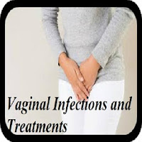 Vaginal Infections  Treatment