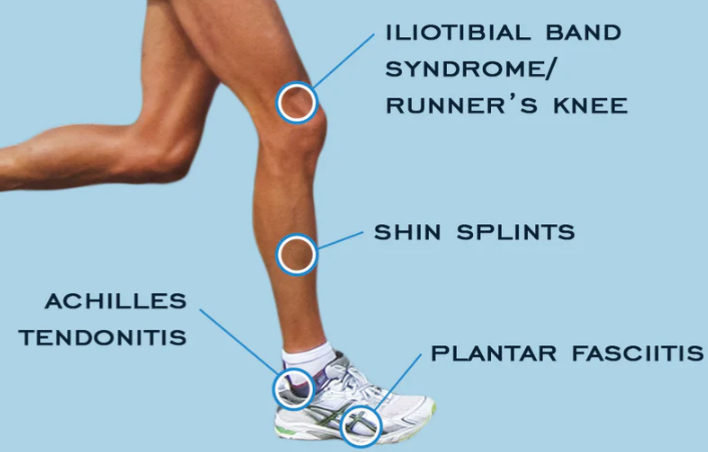 running injuries