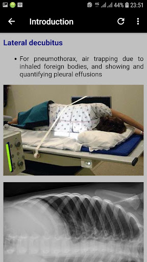 The Basics Of Chest X-Ray Interpretation