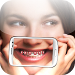 Brace my Photo Apk