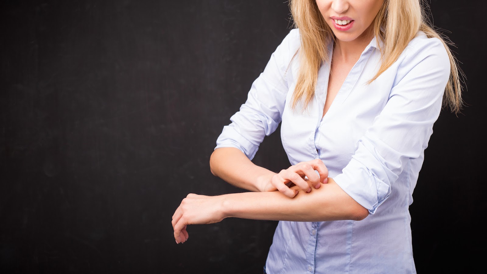 Ahora, crecen los casos de erupciones cutáneas, caída del cabello y urticaria entre las nuevas manifestaciones que presentan los enfermos por COVID (iStock)