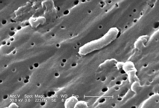 Cholera is a potentially deadly disease spread by eating or drinking food or water contaminated with the faeces of infected people. File photo.