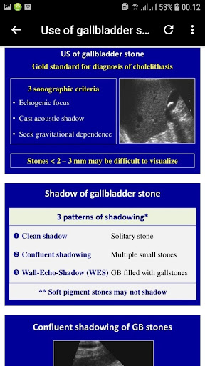 abdominal ultrasound of gallbladder - GUIDE APP