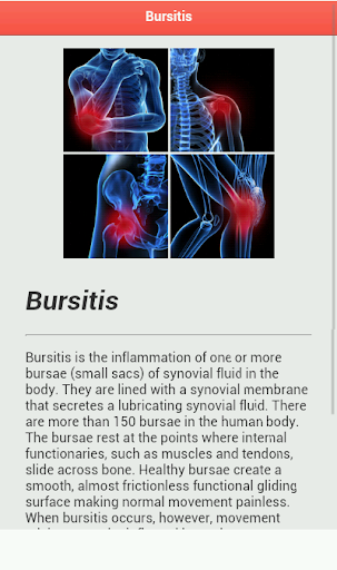 免費下載醫療APP|Bursitis Disease app開箱文|APP開箱王