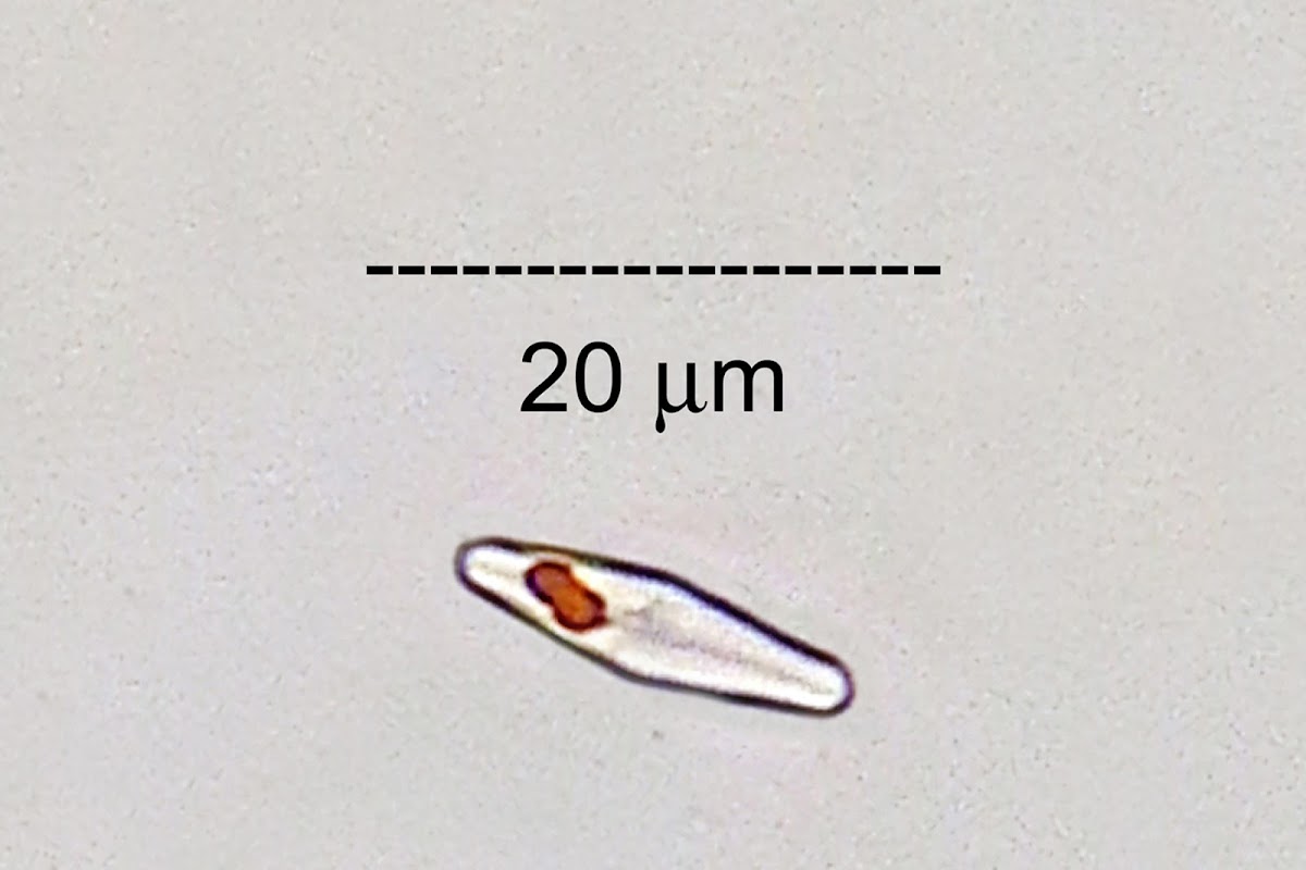 Epilithic Diatom