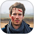 FIGHT PHOTO EDITOR With Injury Prank Stickers29.0