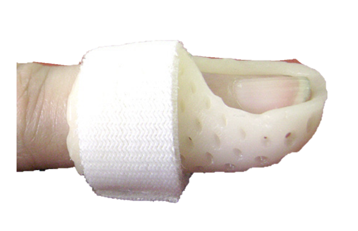 Mallet Finger treatment Raleigh Hand Surgeon 