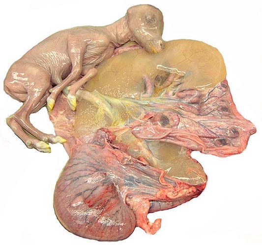 Opened uterus with fetus