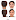 Dallas Otoplasty Surgeon Dr Randy Sanovich Dallas Surgical Arts Ear Surgery