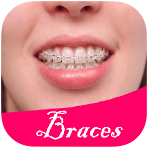 Download Photo Editor: Top Braces Teeth For PC Windows and Mac