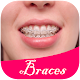 Download Photo Editor: Top Braces Teeth For PC Windows and Mac 1.0