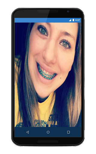 Android application Top Disegn Braces Teeth Camera screenshort