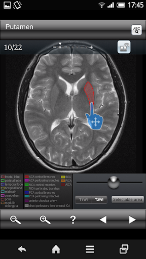 Brain MRI Sectional Wlker