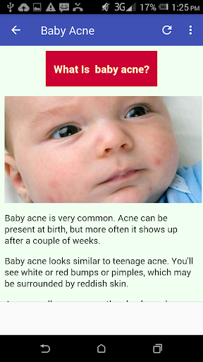 Baby's Rash Guide