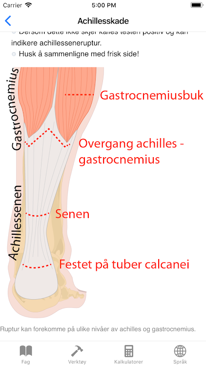 Bartholinitt gravid