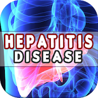 Hepatitis Disease CausesDiagnosis and Management