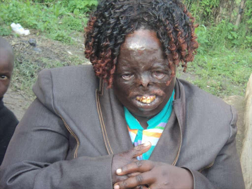 Joyce Cheruiyot a post election violence survivor at her home in Kuresoi. PHOTO FILE