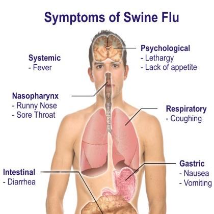 Swine Flu Home Remedies