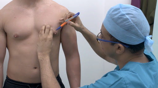 Dr Hassan Nurein | Gynecomastia Surgery Video | Patient Case Study 2 - John