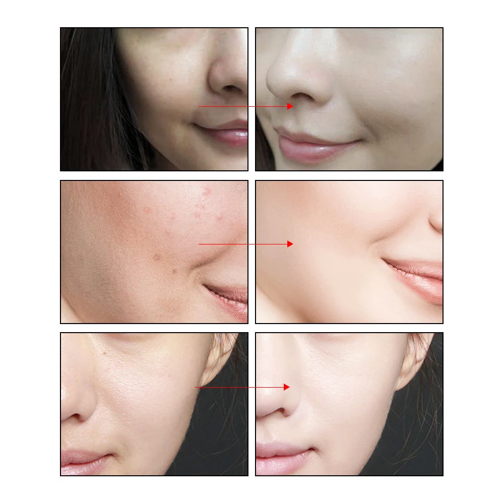 images slider number - 2
