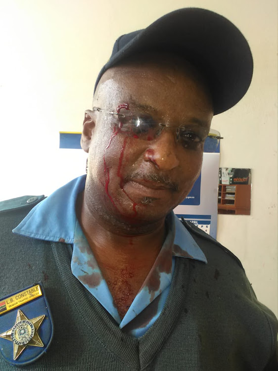 Traffic officer Lawrence Constable after being stabbed above the eye. Buffalo City municipality provided a black and white photograph as it was less graphic than a colour picture would be.