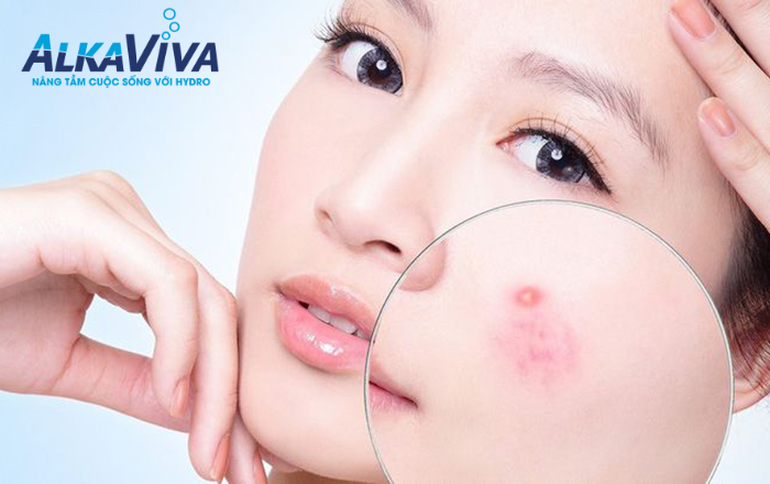 NƯỚC ĐIỆN GIẢI – LIỆU PHÁP LÀM ĐẸP TỰ NHIÊN HOÀN HẢO
