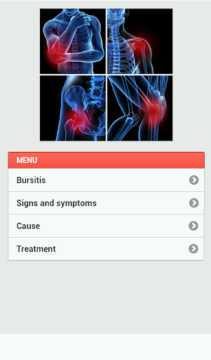 Bursitis Disease