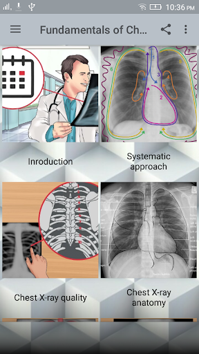 Chest X-Ray Interpretation