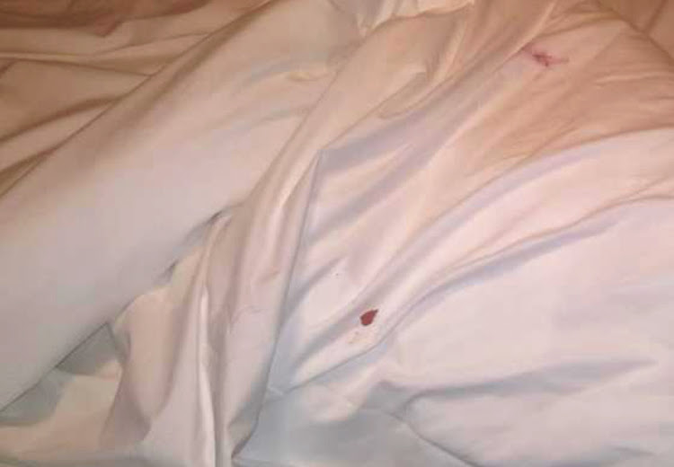 Blood spots on the linen in the room at the Capital 20 West in Sandton on 13 August 2017.