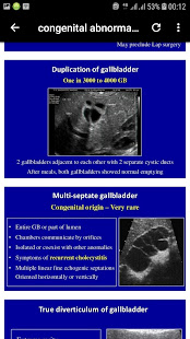 abdominal ultrasound of gallbladder(圖7)-速報App
