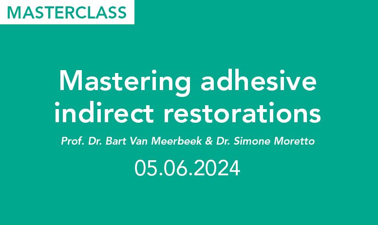 Mastering adhesive indirect restorations