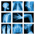 Medical X-Ray Interpretation with 100+ Cases3.7